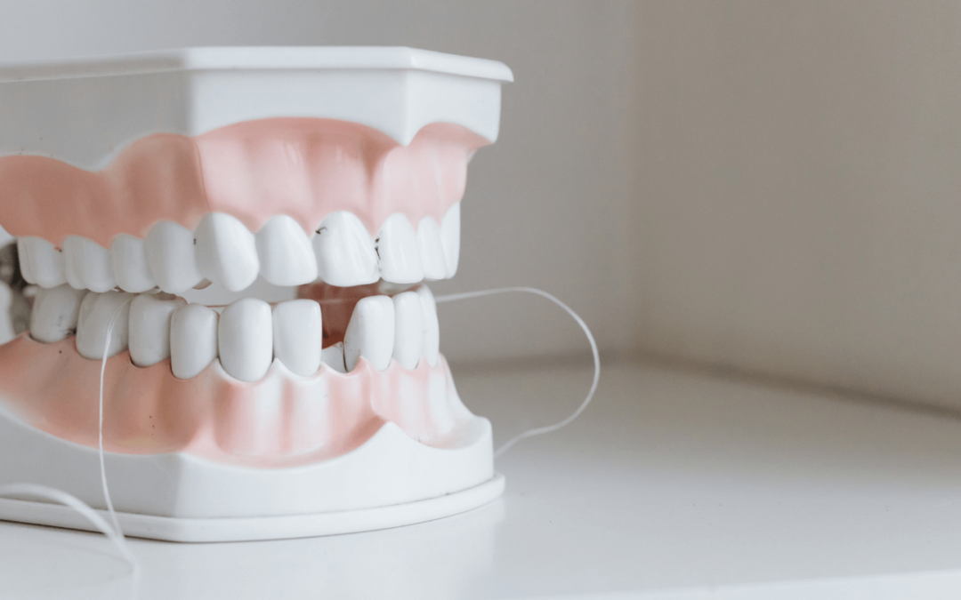 Do you really need to floss?